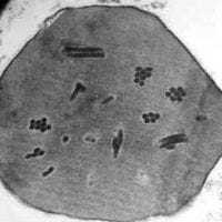 Baculovirus Particles