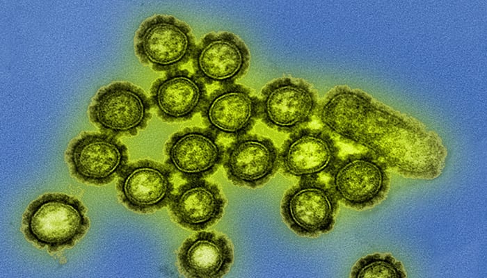 A microscopic image of H1N1 influenza virus particles. (Image courtesy of the National Institute of Allergy and Infectious Diseases)